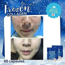 Load image into Gallery viewer, 5 X Frozen Collagen Gluta 2 in 1 whitening x10, Reduce Acne, Freckle 60 Caps