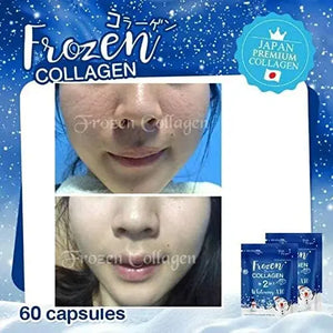 5 X Frozen Collagen Gluta 2 in 1 whitening x10, Reduce Acne, Freckle 60 Caps