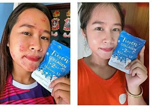 5 X Frozen Collagen Gluta 2 in 1 whitening x10, Reduce Acne, Freckle 60 Caps