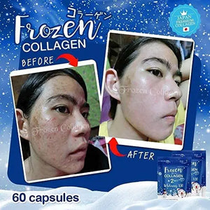 5 X Frozen Collagen Gluta 2 in 1 whitening x10, Reduce Acne, Freckle 60 Caps