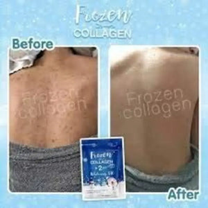 5 X Frozen Collagen Gluta 2 in 1 whitening x10, Reduce Acne, Freckle 60 Caps