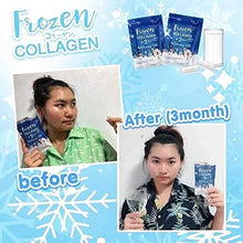 Load image into Gallery viewer, 5 X Frozen Collagen Gluta 2 in 1 whitening x10, Reduce Acne, Freckle 60 Caps