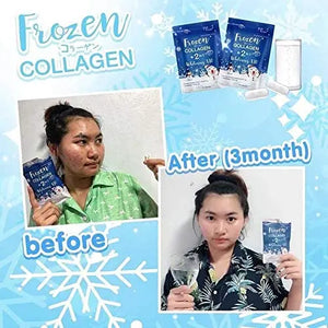 5 X Frozen Collagen Gluta 2 in 1 whitening x10, Reduce Acne, Freckle 60 Caps