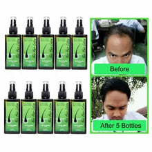 Load image into Gallery viewer, Neo Hair Lotion, Authentic, Hair Lost Treatment, 1 Bottle, 120 Ml