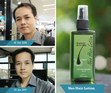 Load image into Gallery viewer, Neo Hair Lotion, Authentic, Hair Lost Treatment, 1 Bottle, 120 Ml